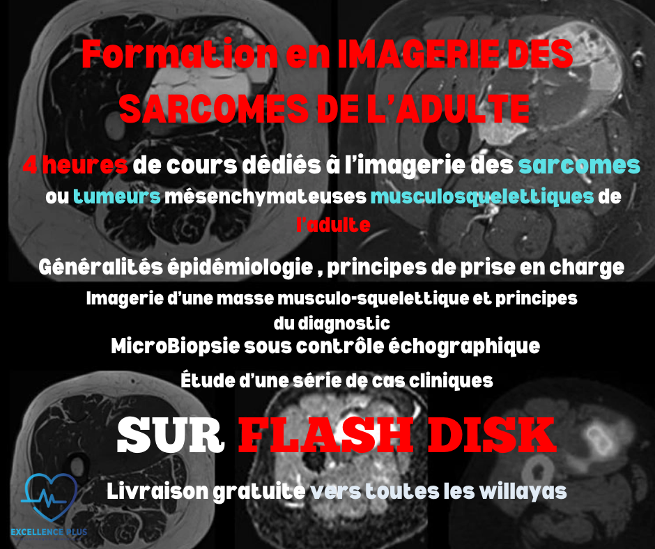 OFFRE (2en1) : Pack échographie ostéoarticulaire musclo squelettique + IMAGERIE DES SARCOMES DE L’ADULTE